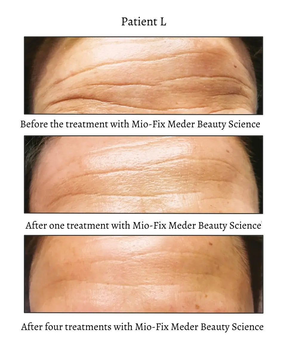 Myo Fix Concentrate - Meder Beauty Science Meder