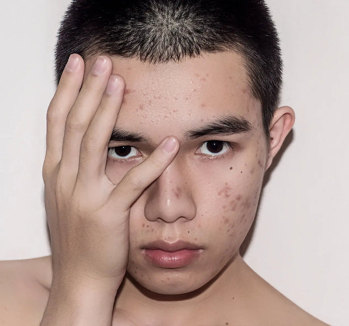 Teenage Facial Timeless Beauty